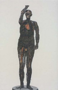 A woman that was disected and preserved in 1760, from the museum collection. A woman that was disected and preserved in 1760, from the museum collection.
