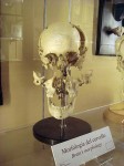 The bones of a skull pulled apart